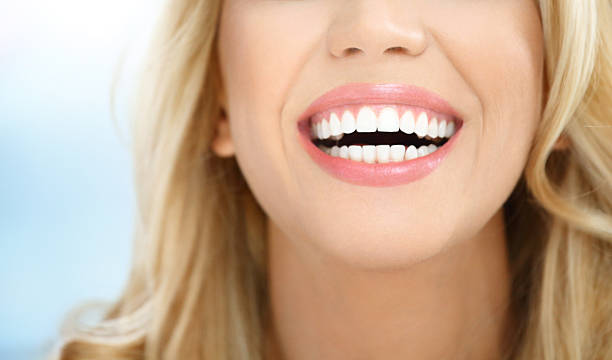 7 Cara Merapikan Gigi Tanpa Behel yang Aman dan Nyaman