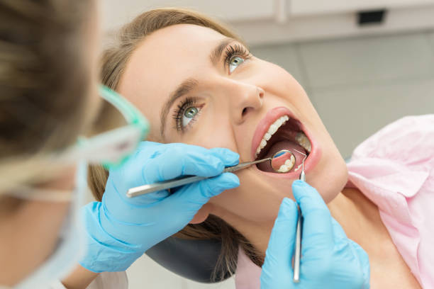 Apa Itu Karang Gigi? Penyebab dan Pengobatannya yang Tepat