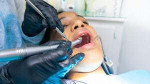 Memahami Pentingnya Perawatan Gigi Remaja- Panduan untuk Tambal Gigi yang Aman dan Nyaman